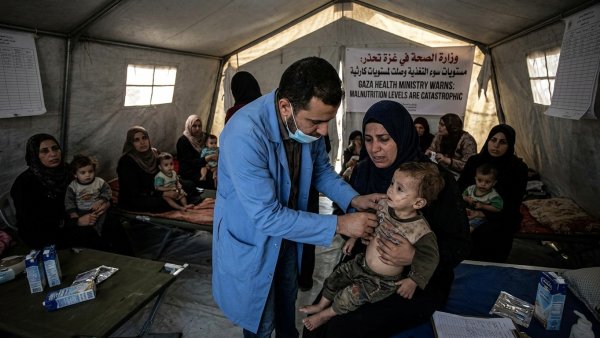 Gaza Health Ministry Warns Malnutrition Has Reached Catastrophic Levels